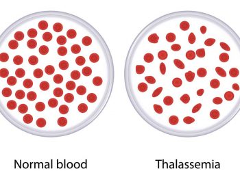 تالاسمی مینور و ماژور