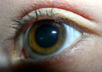 آب سیاه چیست