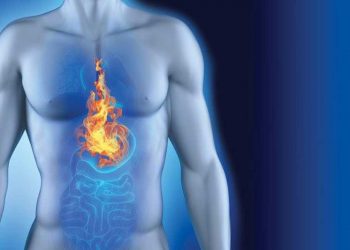 رفلاکس معده