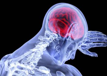 علائم سکته مغزی