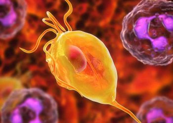 تریکومونیازیس