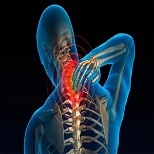 8 نشانه_ای که ممکن است به دیسک گردن مبتلا شده باشید و درمان قطعی 