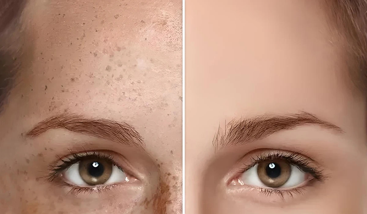 لیزر کیوسوییچ کرمانشاه