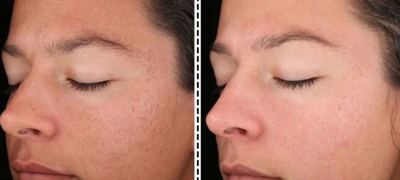 لیزر کیوسوییچ کرمانشاه