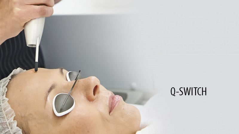 لیزر کیوسوییچ کرمانشاه